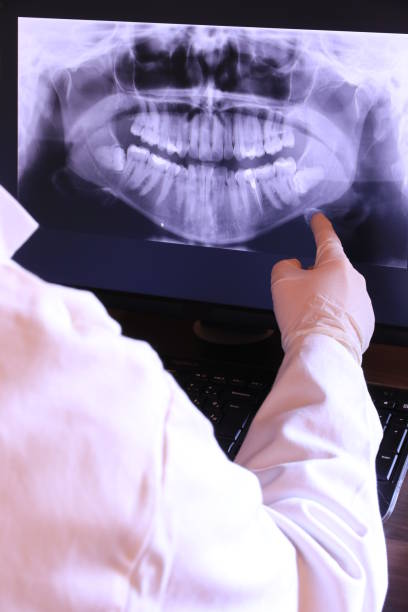 Best Emergency Treatment for Dental Infections or Abscesses in Putnam Lake, NY